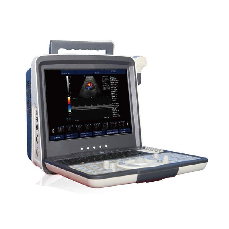 Portable Color Doppler