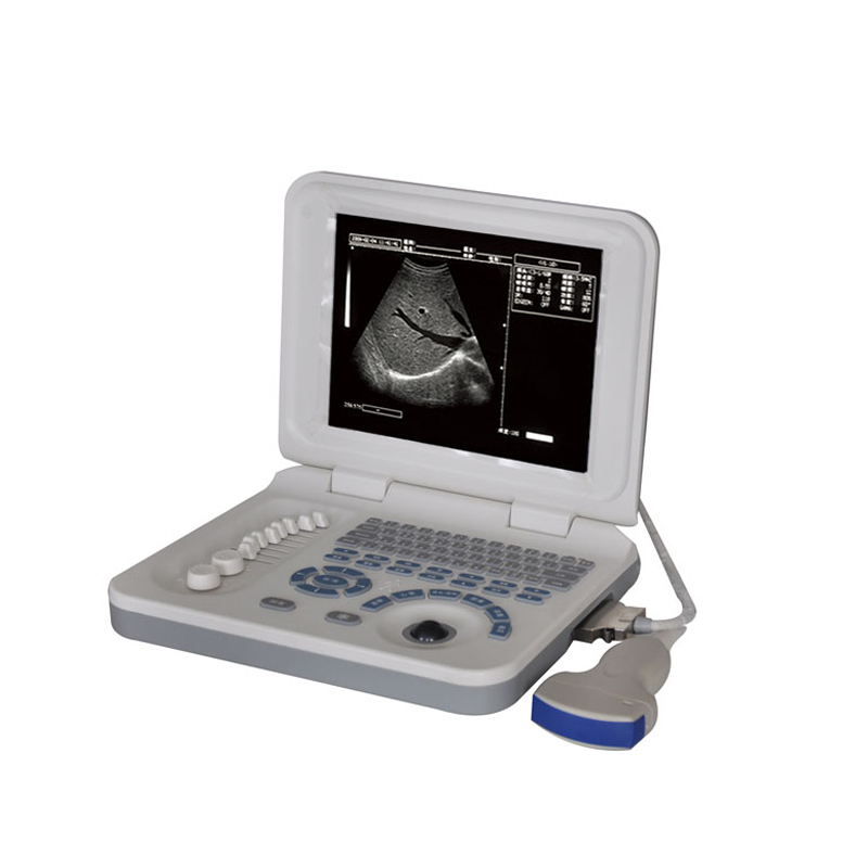 Full Digital Laptop Ultrasound Scanner
